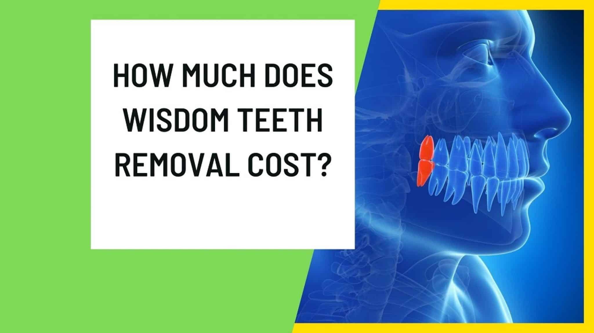 How Much Does Wisdom Teeth Removal Cost?