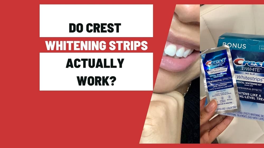 Do crest whitening strips actually work