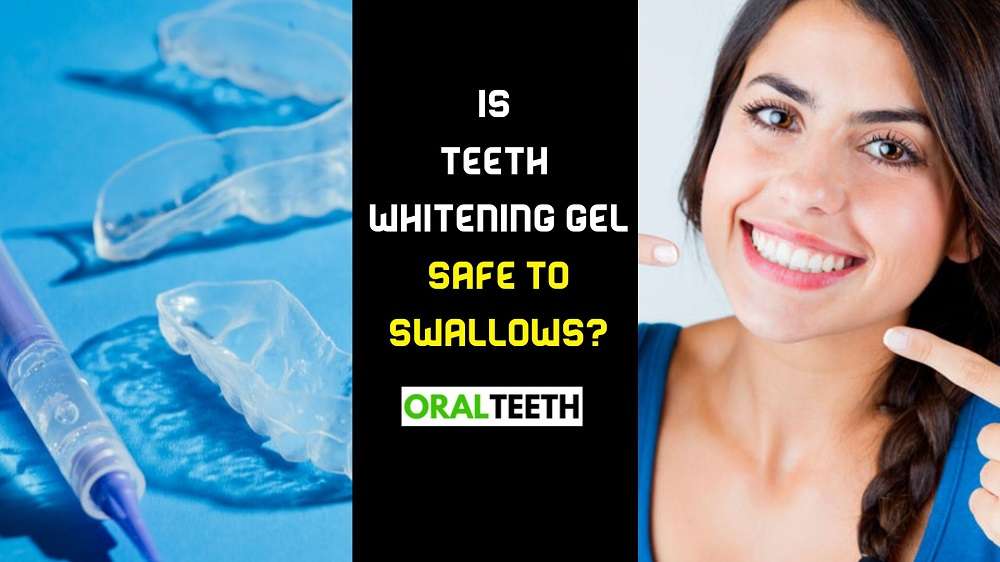 Is teeth whitening gel safe to swallows