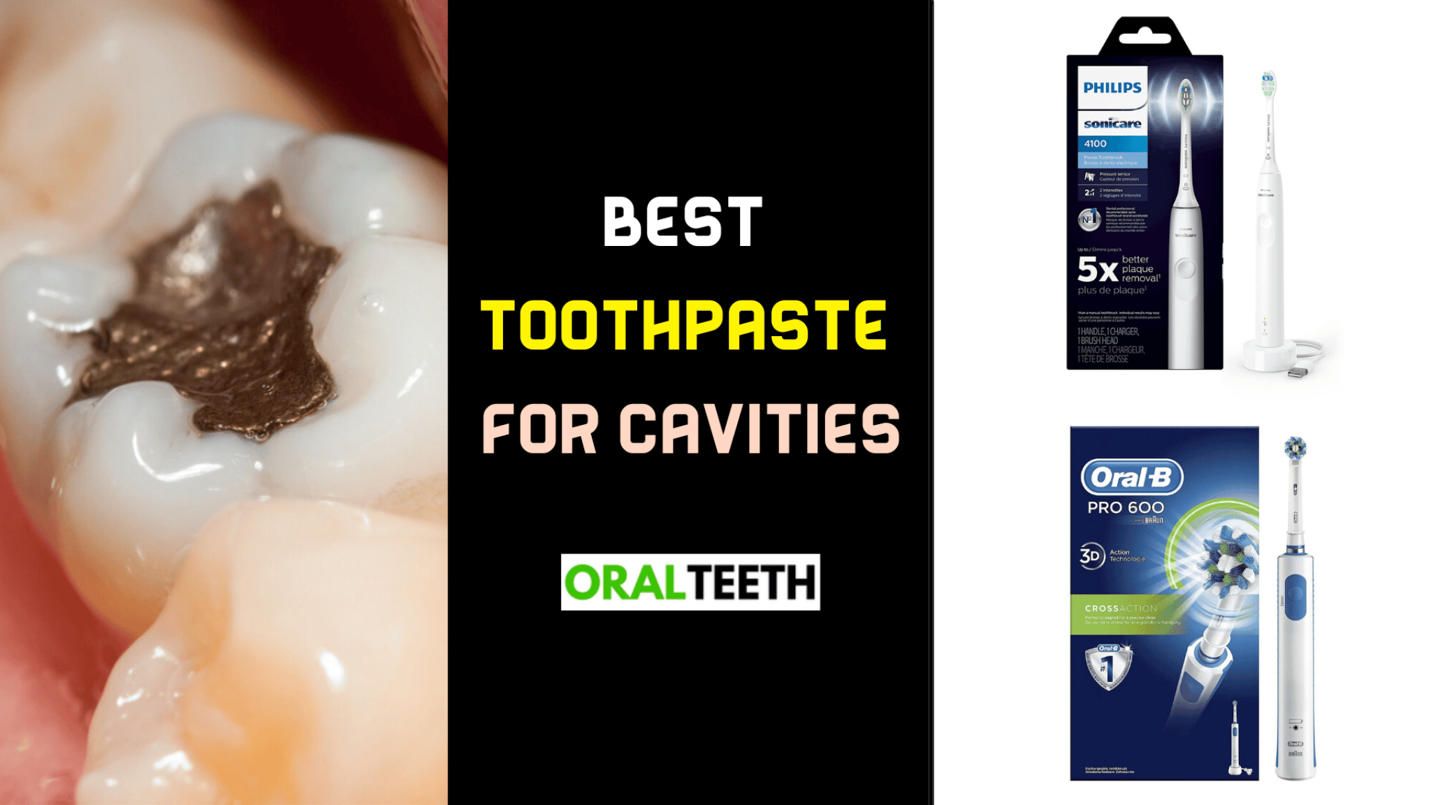 5 Best Toothpaste For Cavities