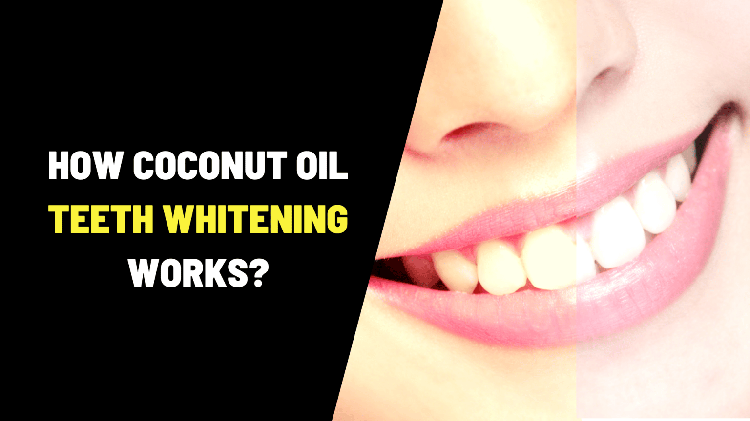 How Coconut Oil Teeth Whitening Works?