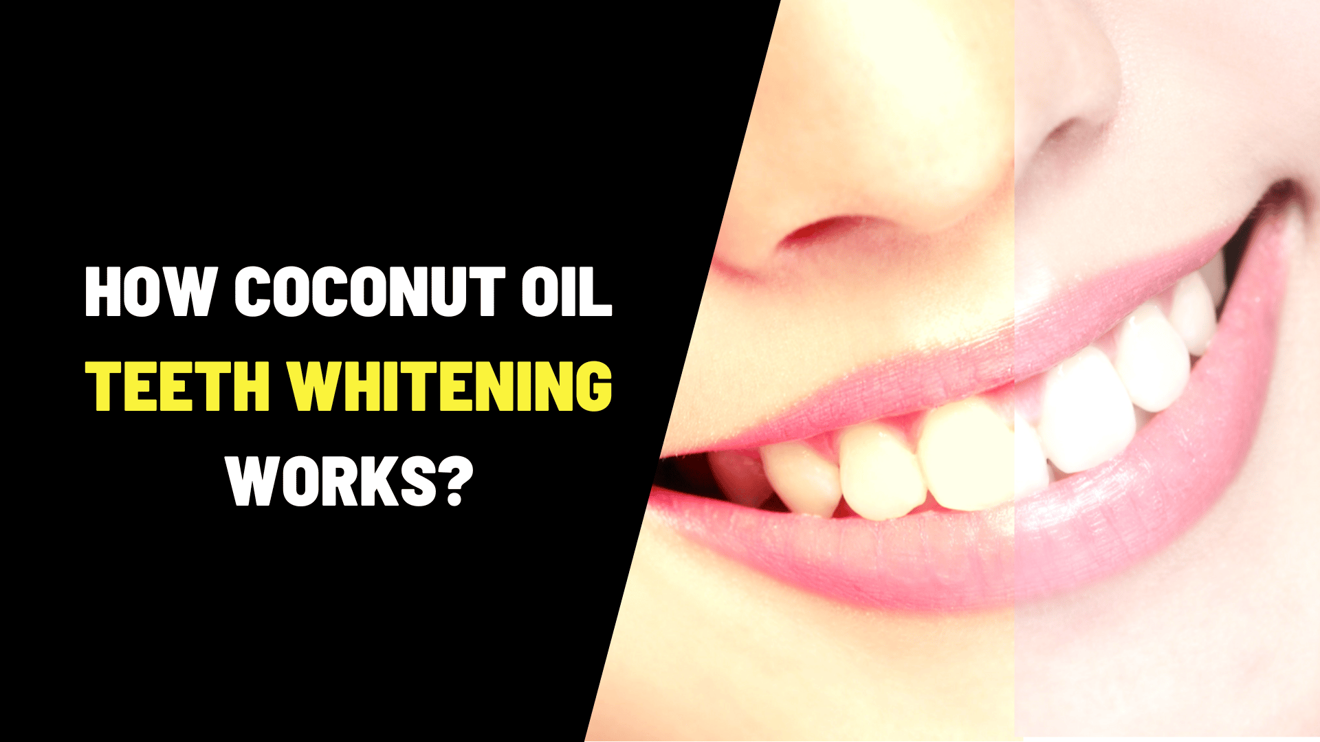 How Coconut Oil Teeth Whitening Works